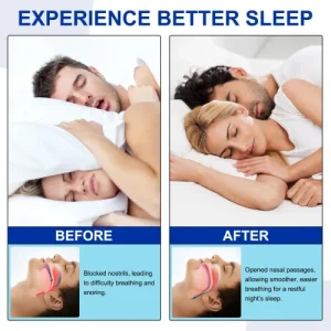 Anti-Snore Nose Strips